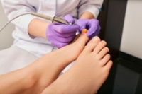 The Benefits of Laser Therapy for Fungal Nails